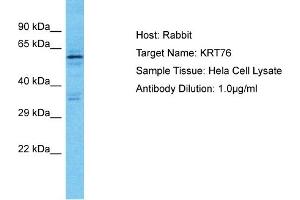 Host: Rabbit Target Name: KRT76 Sample Type: Hela Whole Cell lysates Antibody Dilution: 1. (Cytokeratin 2 抗体  (C-Term))
