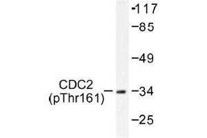 Image no. 1 for anti-Cyclin-Dependent Kinase 1 (CDK1) (pThr161) antibody (ABIN317981) (CDK1 抗体  (pThr161))