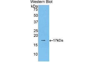 Western blot analysis of the recombinant protein. (LGALS9B 抗体  (AA 17-148))