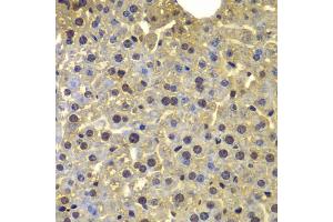 Immunohistochemistry of paraffin-embedded mouse liver using SORT1 antibody. (Sortilin 1 抗体)