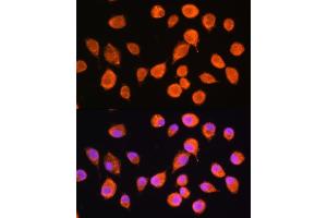 Immunofluorescence analysis of L929 cells using SMPD4 Rabbit pAb (ABIN7270531) at dilution of 1:100. (SMPD4 抗体  (AA 600-800))