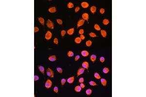 Immunofluorescence analysis of L929 cells using SMPD4 Rabbit pAb (ABIN7270531) at dilution of 1:100. (SMPD4 抗体  (AA 600-800))