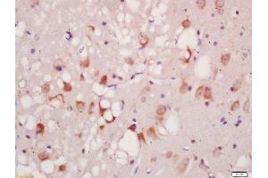 Formalin-fixed and paraffin embedded rat brain labeled with Anti-Phospho-ATG1(Ser556)Polyclonal Antibody, Unconjugated  at 1:200 followed by conjugation to the secondary antibody and DAB staining (ULK1 抗体  (pSer556))