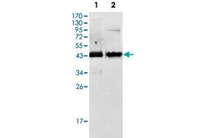 Western blot analysis of AMACR monoclonal antibody, clone 2A10F3  against Jurkat (1) and LNCaP (2) cell lysate. (AMACR 抗体)