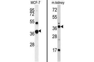 Image no. 1 for anti-Fructose-1,6-Bisphosphatase 1 (FBP1) (Middle Region) antibody (ABIN452992) (FBP1 抗体  (Middle Region))