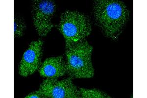 A549 cells were stained with Cytokeratin 13 (5A3) Monoclonal Antibody  at [1:200] incubated overnight at 4C, followed by secondary antibody incubation, DAPI staining of the nuclei and detection. (Cytokeratin 13 抗体)