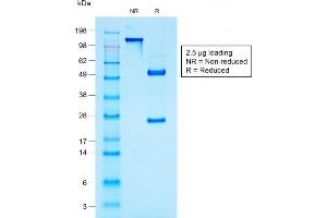 SDS-PAGE Analysis Purified MUC1 Mouse Recombinant Monoclonal Antibody (rMUC1/960). (Recombinant MUC1 抗体)