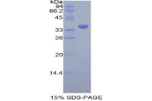 SDS-PAGE analysis of Human PRAME Protein. (PRAME 蛋白)