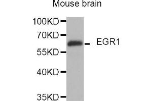 Western blot analysis of extracts of mouse brain, using EGR1 antibody (ABIN5974370). (EGR1 抗体)