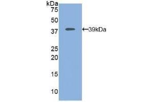 Detection of Recombinant MAP2K1, Human using Polyclonal Antibody to Mitogen Activated Protein Kinase Kinase 1 (MAP2K1) (MEK1 抗体  (AA 54-369))