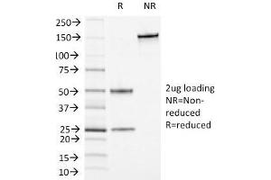 SDS-PAGE Analysis Purified CD13 Mouse Monoclonal Antibody (APN/1464). (CD13 抗体)