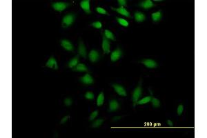 Immunofluorescence of purified MaxPab antibody to PSRC2 on HeLa cell. (ZFC3H1 抗体  (AA 1-358))