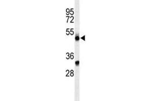 Western blot analysis of CFP antibody and CEM lysate. (CFP 抗体  (AA 197-223))