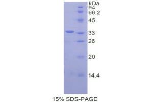 SDS-PAGE analysis of Human CREB Binding Protein. (CBP 蛋白)