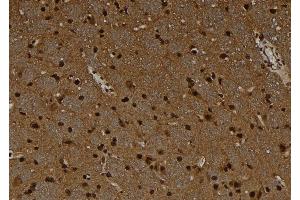 ABIN6278675 at 1/100 staining Rat brain tissue by IHC-P. (MAGEC1 抗体)