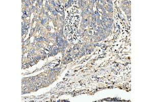 IHC analysis of CD63 using anti-CD63 antibody (ABIN3043395).