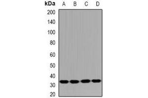 Western blot analysis of HUS1B expression in Jurkat (A), mouse spleen (B), mouse thymus (C), rat testis (D) whole cell lysates. (HUS1B 抗体)