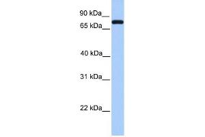 Complement C2 antibody used at 1 ug/ml to detect target protein. (Complement C2 抗体  (N-Term))