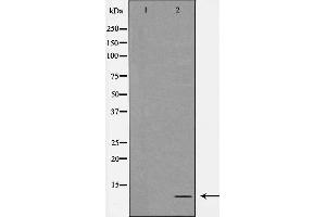 Western Blotting (WB) image for anti-ATP Synthase, H+ Transporting, Mitochondrial F0 Complex, Subunit E (ATP5I) (C-Term) antibody (ABIN6258537)