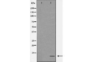 Western blot analysis of extracts from COLO cells, using ATP5I antibody.