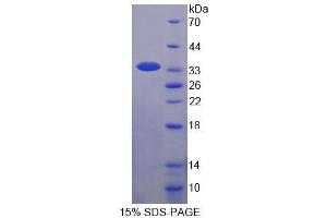 SDS-PAGE analysis of Human WWP2 Protein. (WWP2 蛋白)
