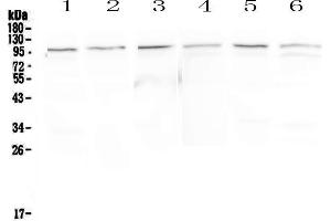 Western blot analysis of MVP using anti-MVP antibody . (MVP 抗体  (AA 2-259))