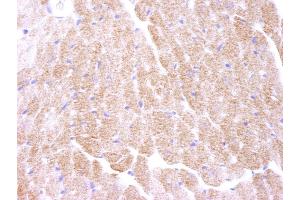 Immunohistochemistry (IHC) image for anti-Protein Kinase, AMP-Activated, alpha 1 Catalytic Subunit (PRKAA1) (AA 350-400) antibody (ABIN7448407)