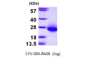 SDS-PAGE (SDS) image for Chromosome 6 Open Reading Frame 108 (C6orf108) (AA 1-174) protein (His tag) (ABIN667201) (RCL Protein (AA 1-174) (His tag))