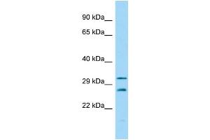 Host:  Rabbit  Target Name:  Csnk2b  Sample Type:  Mouse Testis lysates  Antibody Dilution:  1. (CSNK2B 抗体  (N-Term))
