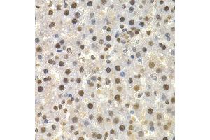 Immunohistochemistry of paraffin-embedded rat liver using TOR1A antibody at dilution of 1:200 (400x lens). (TOR1A 抗体)
