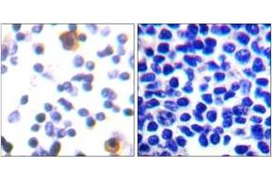 Immunohistochemistry analysis of paraffin-embedded human lymph node, using ZAP-70 (Phospho-Tyr315) Antibody.