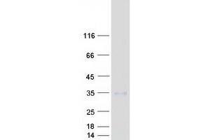 Western Blotting (WB) image for C1q and Tumor Necrosis Factor Related Protein 3 (C1QTNF3) (Transcript Variant 1) protein (Myc-DYKDDDDK Tag) (ABIN2715463)