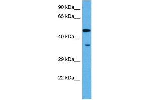 Host:  Rabbit  Target Name:  MEF2A  Sample Tissue:  Rat Skeletal Muscle  Antibody Dilution:  1ug/ml (MEF2A 抗体  (N-Term))