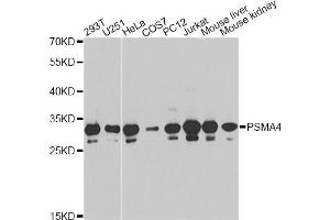 Western blot analysis of extracts of various cell lines, using PSMA4 antibody (ABIN6291447) at 1:1000 dilution. (PSMA4 抗体)