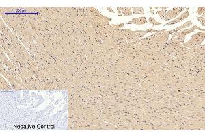 Immunohistochemical analysis of paraffin-embedded rat heart tissue. (JNK 抗体  (pThr183))