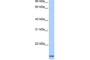 WB Suggested Anti-CCNL2 Antibody Titration:  0. (Cyclin L2 抗体  (N-Term))