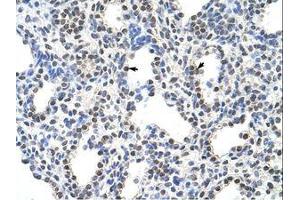 Image no. 1 for anti-serine/arginine-Rich Splicing Factor 10 (SRSF10) (C-Term) antibody (ABIN6736232) (SRSF10 抗体  (C-Term))