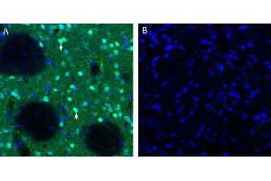 Free-floating frozen brain sections from a paraformaldehyde-perfused rat were incubated with Anti-Neurokinin 2 Receptor (NK2R) Antibody (ABIN7043806, 1:200), followed by goat anti-rabbit secondary antibody conjugated to Alexa Fluor® 488 (green). (TACR2 抗体  (Intracellular, N-Term))