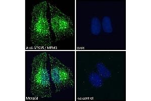 Immunofluorescence (IF) image for anti-Vacuolar Protein Sorting 35 (VPS35) (C-Term) antibody (ABIN185182)