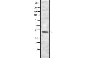 Western blot analysis of OR1J1 expression in HEK293 cells ,The lane on the left is treated with the antigen-specific peptide. (OR1J1 抗体)