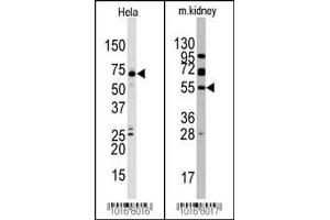 Western blot analysis of anti-JMJD4 (C-term) Pab in Hela and mouse kidney cell line lysate. (JMJD4 抗体  (C-Term))