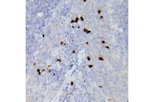 Immunohistochemistry (IHC) image for anti-S100 Calcium Binding Protein A9 (S100A9) (AA 1-114) antibody (ABIN6147345)