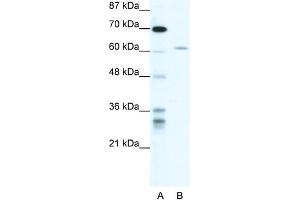 WB Suggested Anti-ZNFN1A4 Antibody Titration: 1. (IKZF4 抗体  (N-Term))