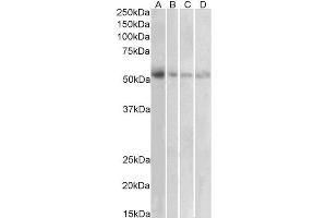 Antibody (1µg/ml) staining of Human Placenta (A), Human Uterus (B), Human Adrenal Gland (C) and Human Pancreas (D) lysates (35µg protein in RIPA buffer). (SLC18A2 抗体  (C-Term))
