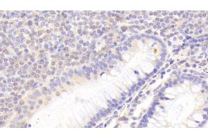 Detection of KLRC2 in Human Colon Tissue using Polyclonal Antibody to Killer Cell Lectin Like Receptor Subfamily C, Member 2 (KLRC2) (KLRC2 抗体  (AA 19-190))