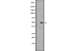 Western blot analysis of GASR expression in A431 whole cell lysate ,The lane on the left is treated with the antigen-specific peptide. (CCKBR 抗体  (N-Term))