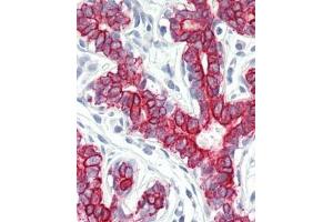 Immunhistochemistry analysis in human breast tissue (Formalin-fixed, Paraffin-embedded) using Peroxin 7 / PEX7  (PEX7 抗体  (Internal Region))