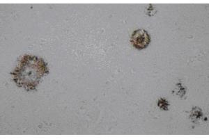 Immunohistochemistry (IHC) image for anti-Amyloid beta (Abeta) (AA 1-16), (N-Term) antibody (ABIN1105360) (beta Amyloid 抗体  (N-Term))