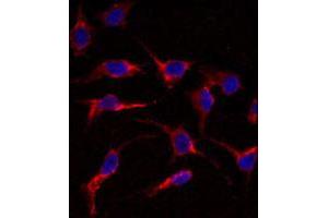 Immunofluorescence analysis of ERAS polyclonal antibody  in HeLa cells. (ERAS 抗体  (N-Term))