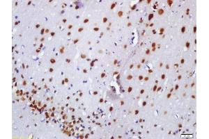 Formalin-fixed and paraffin embedded rat brain labeled with Anti-BASP1 Polyclonal Antibody, Unconjugated  at 1:200 followed by conjugation to the secondary antibody and DAB staining (BASP1 抗体  (AA 3-100))
